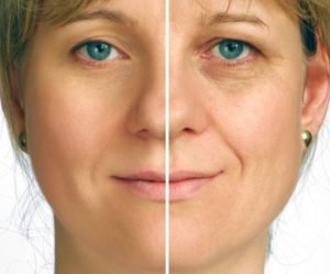Botox® Fillers Lasers Aesthetics Calgary Botox® Fillers Lasers Aesthetics Calgary