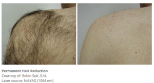 Botox® Fillers Lasers Aesthetics Calgary Botox® Fillers Lasers Aesthetics Calgary
