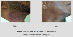 Botox® Fillers Lasers Aesthetics Calgary Botox® Fillers Lasers Aesthetics Calgary