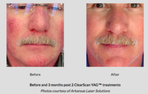 Botox® Fillers Lasers Aesthetics Calgary Botox® Fillers Lasers Aesthetics Calgary