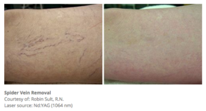 Botox® Fillers Lasers Aesthetics Calgary Botox® Fillers Lasers Aesthetics Calgary