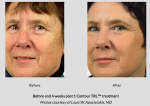 Botox® Fillers Lasers Aesthetics Calgary Botox® Fillers Lasers Aesthetics Calgary
