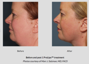 Botox® Fillers Lasers Aesthetics Calgary Botox® Fillers Lasers Aesthetics Calgary