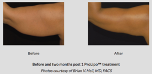 Botox® Fillers Lasers Aesthetics Calgary Botox® Fillers Lasers Aesthetics Calgary