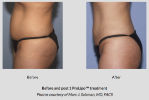 Botox® Fillers Lasers Aesthetics Calgary Botox® Fillers Lasers Aesthetics Calgary