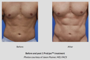 Botox® Fillers Lasers Aesthetics Calgary Botox® Fillers Lasers Aesthetics Calgary