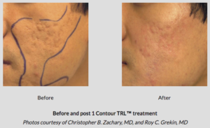 Botox® Fillers Lasers Aesthetics Calgary Botox® Fillers Lasers Aesthetics Calgary