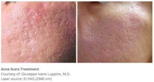Botox® Fillers Lasers Aesthetics Calgary Botox® Fillers Lasers Aesthetics Calgary