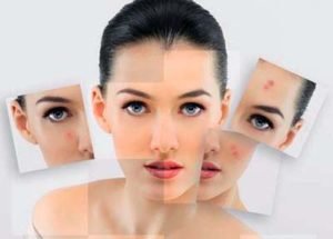 Botox® Fillers Lasers Aesthetics Calgary Botox® Fillers Lasers Aesthetics Calgary