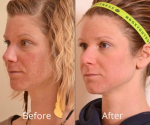 Botox® Fillers Lasers Aesthetics Calgary Botox® Fillers Lasers Aesthetics Calgary