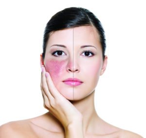 Botox® Fillers Lasers Aesthetics Calgary Botox® Fillers Lasers Aesthetics Calgary