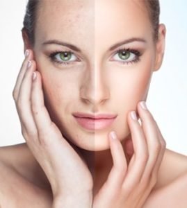 Botox® Fillers Lasers Aesthetics Calgary Botox® Fillers Lasers Aesthetics Calgary